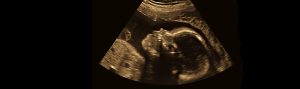 How does an ultrasound work?